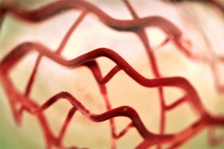 3D Systems soft tissue scaffold.jpg