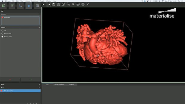 Materialise Mimics inPrint software.png