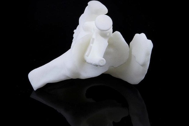 Materialise shoulder model