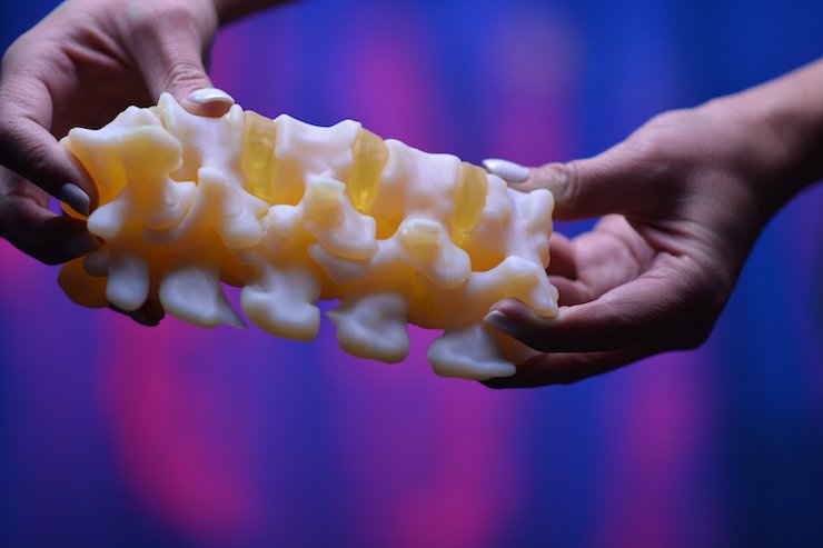 spine_model.jpeg