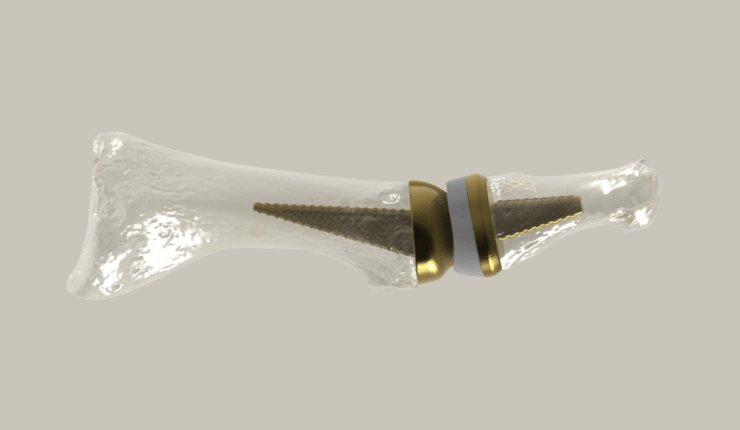Untitled design (13).png